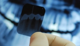 Comunicat Presa Radiologie Dentara